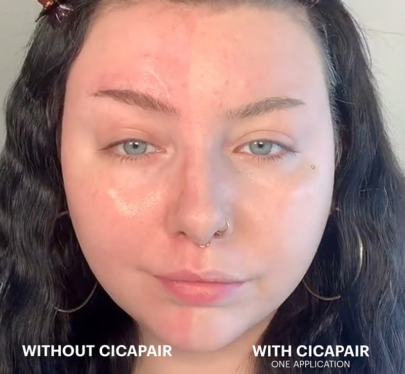 CICAPAIR™ TIGER GRASS COLOR CORRECTING TREATMENT SPF30