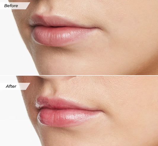 GLOW LIP BALM - WATERMELON