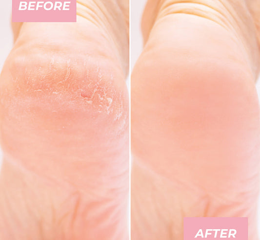 EXFOLIATING FOOT PEEL MASK